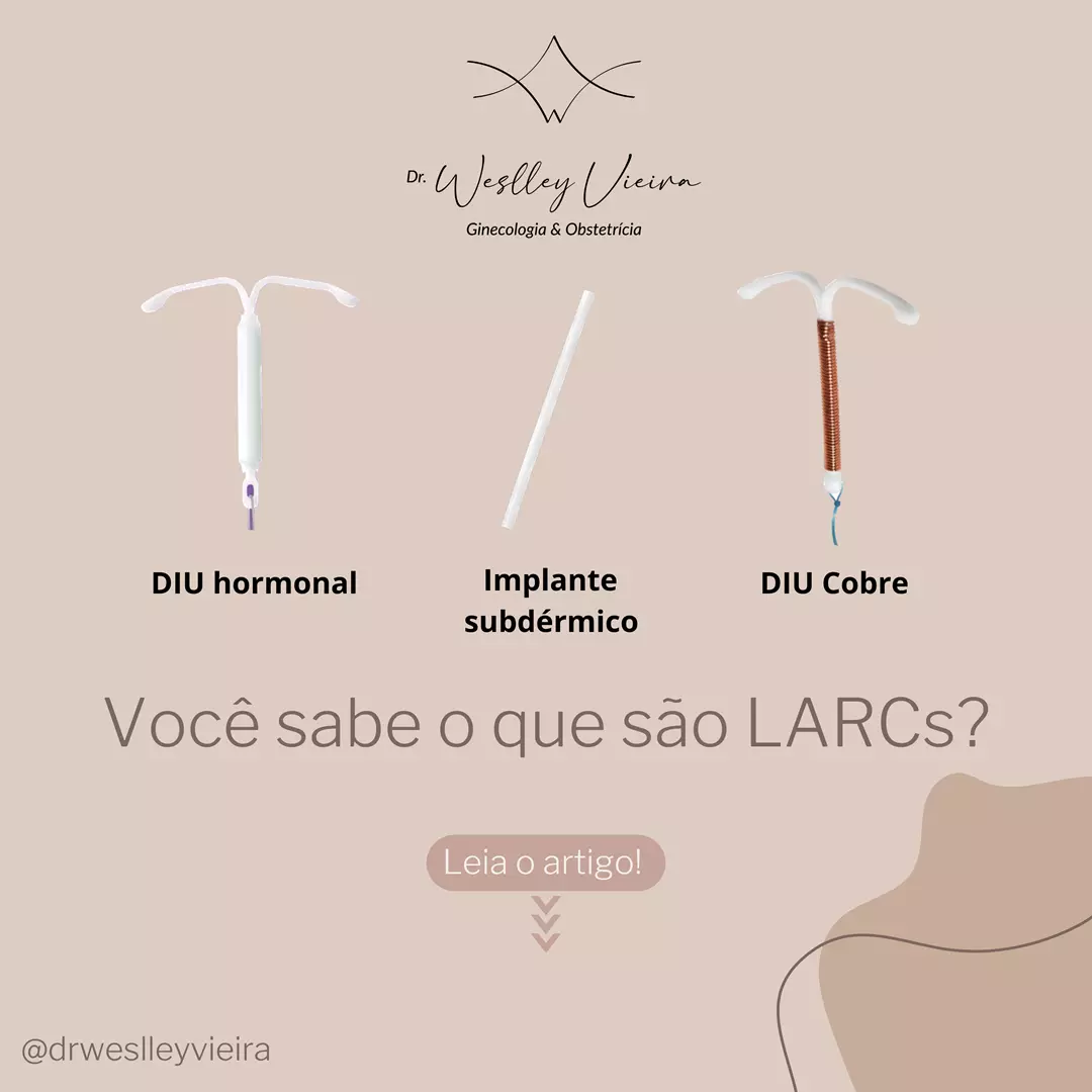 Eficazes na prevenção da gravidez indesejada, LARCs são pouco usados pelas brasileiras Eficazes na prevenção da gravidez indesejada, LARCs são pouco usados pelas brasileiras