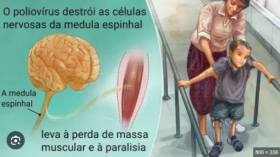 Dia de vacinação contra a poliomielite vai ter posto no Shopping Iguatemi