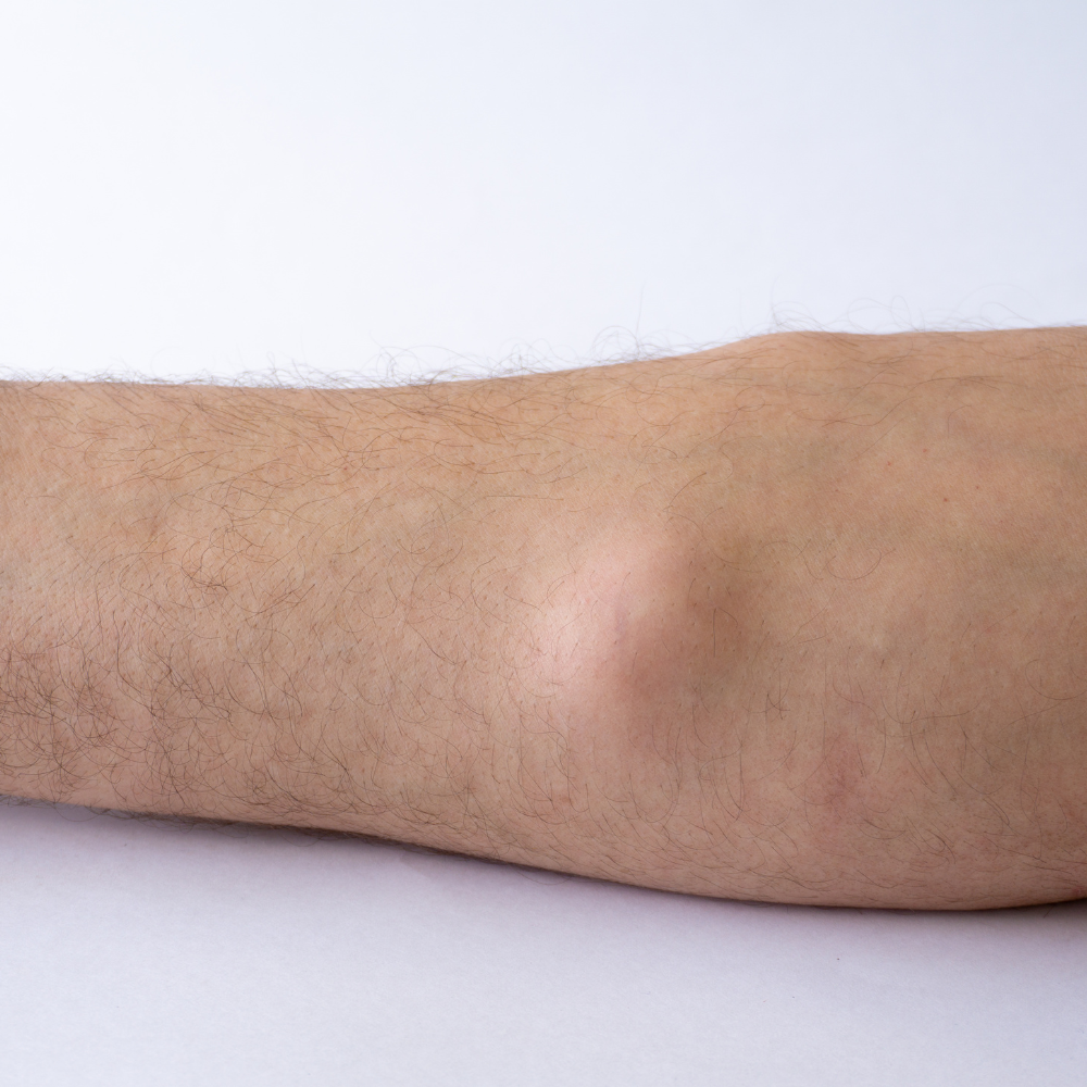 Dermatologia Cirurgica