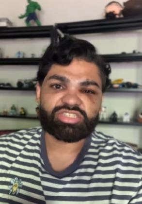 Psicólogo denuncia agressão e afirma ter sido vítima de homofobia em boate de Cuiabá
