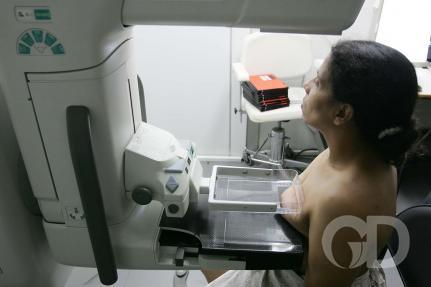 CCJ aprova veto a PL sobre exames de câncer de mama