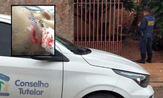 Mãe é presa por maus-tratos após agredir filha de 3 anos com cabo de vassoura em MT