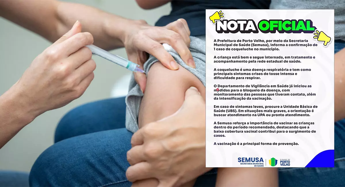 Caso de coqueluche é confirmado e mobiliza ações de saúde na capital