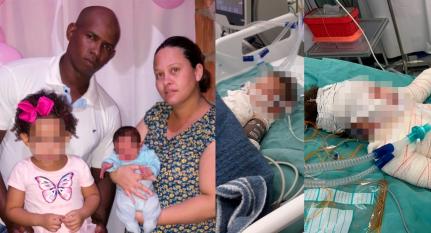 Irmã de bebê morto com queimaduras, morre em hospital após dias internada