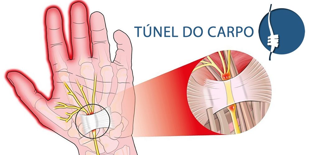 Túnel do Carpo
