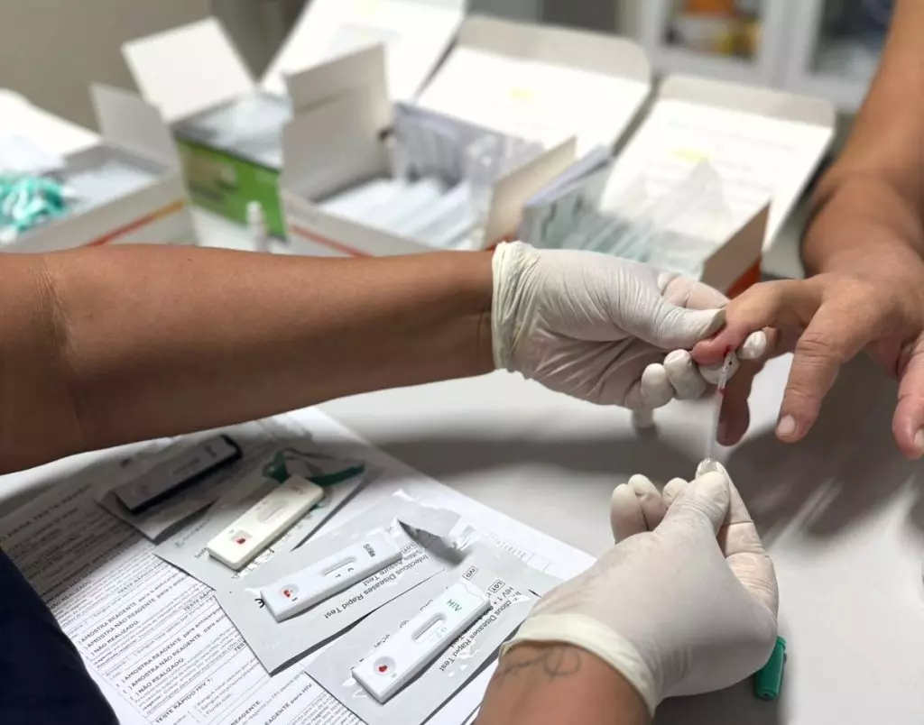 Casos de hepatites virais caem 34% no Amazonas e Saúde reforça importância da prevenção