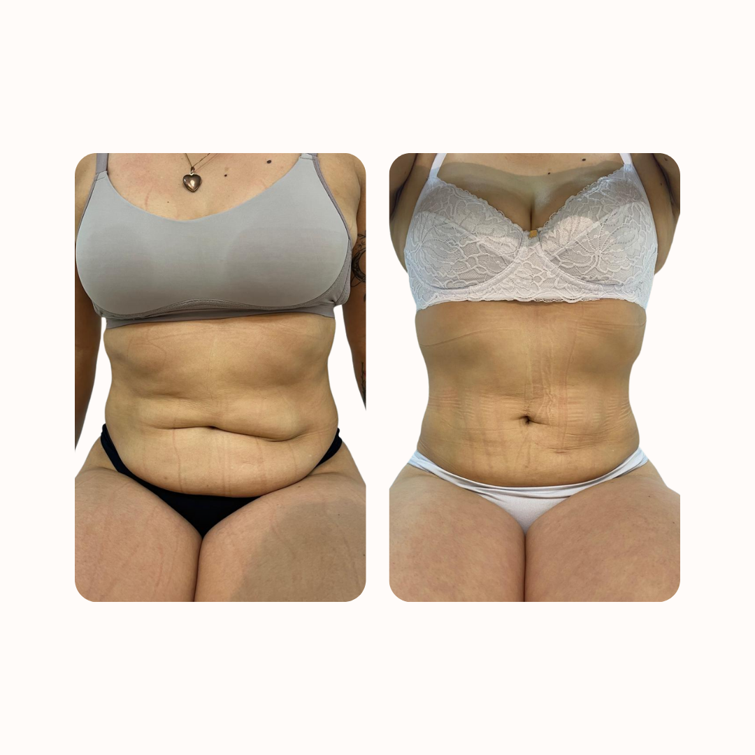 Imagem Segundaria do Produto