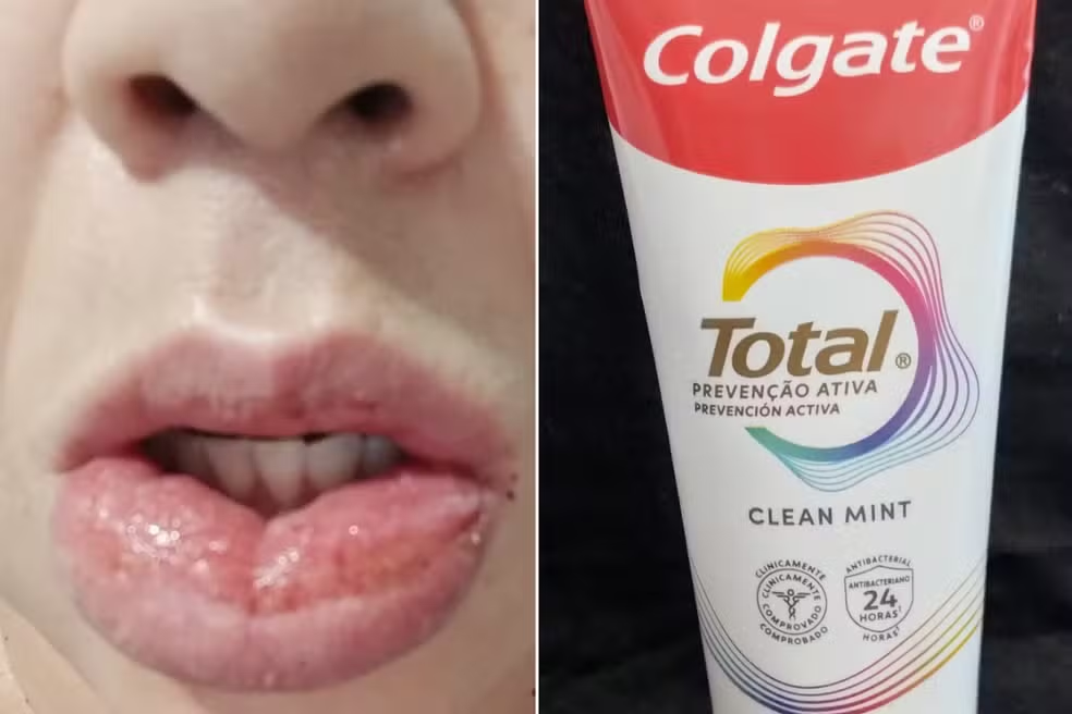 Anvisa volta a interditar creme dental da Colgate