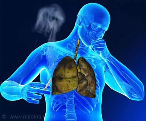 Prefeitura promove campanha para o Dia Mundial de Combate à Tuberculose