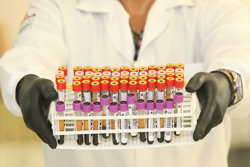 Setembro Verde: Hemocentro de Brasília já fez mais de 5 mil exames pré e pós-transplantes em 2025