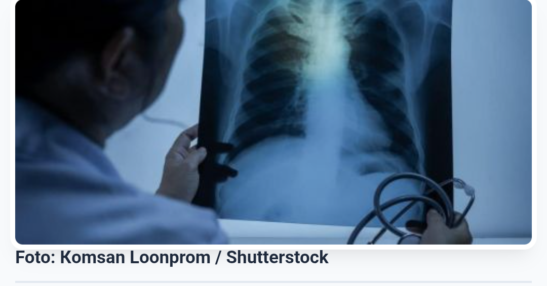 Lei institui campanha para conscientização sobre câncer de pulmão